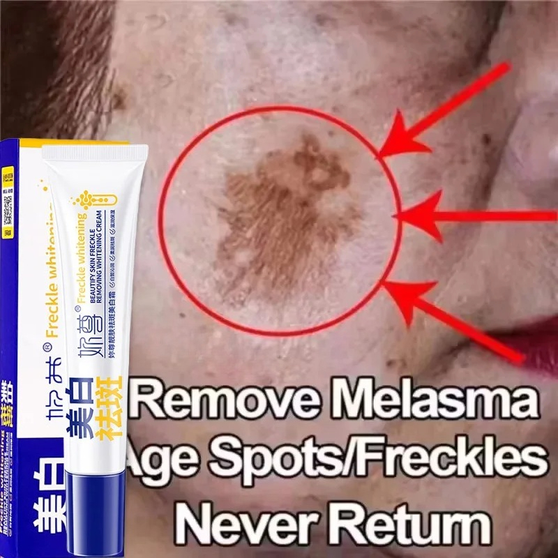 Powerful Spot-Removing Whiten  - Skincare Korea review and price