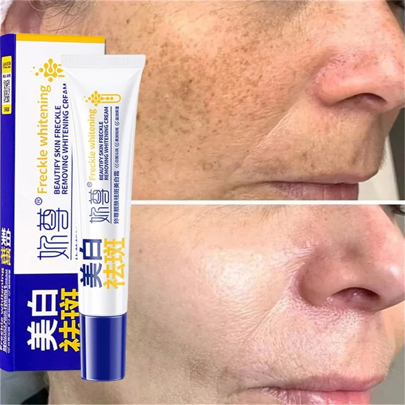 Powerful Spot-Removing Whiten  - Skincare Korea review and price