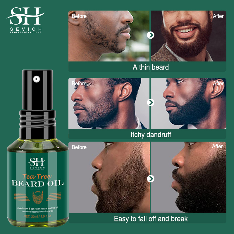 Tea Tree Beard Oil Set For Men - Tea Tree Spot Treatment review and price
